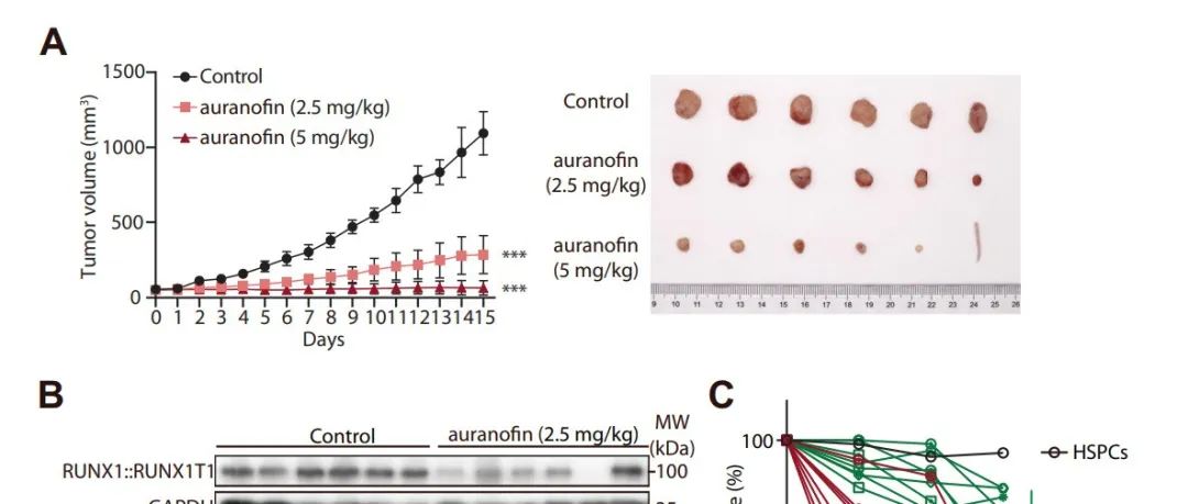 Leukemia | 浙江大学应美丹/黄河/杨波揭示了USP6调控RUNX1融合蛋白转录活性的新生物学功能