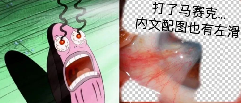眼睛被晒伤……是一种什么样的体验？