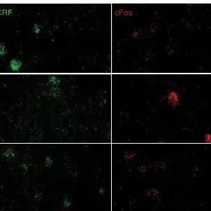 Nature子刊 | 男女做实验，结果大不同！实验小鼠偏爱女性，厌恶男性，原因竟如此炸裂......