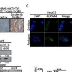Sci Transl Med | 香港大学马桂宜等人研究发现AGPAT4介导的肿瘤谱系可塑性是肝细胞癌治疗新靶点