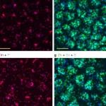 TEM图像处理软件DigitalMicrograph下载：SAED衍射标定、晶面间距、EELS分析、元素标定、上色、衬度调整等