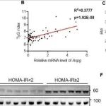 EMBO J | 复旦大学潘东宁研究发现肝脏ASPG介导的溶血磷脂酰肌醇分解代谢损害胰岛素信号转导
