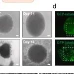 Bioact Mater丨首都医科大学保肇实等团队研发出一种保留胶质瘤微环境的新型类器官模型，用于个性化药物筛选和治疗评估