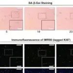 eLife丨北京大学陶伟等团队发现依那普利通过磷酸化的 Smad1/5/9 靶向抗氧化基因来减轻衰老和与衰老相关的表型