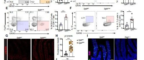 Sci Immunol | 西湖大学胡小玉/中国医学科学院肿瘤研究所郭雪坤揭示簇细胞通过转录因子Spi-B抑制肠道2型免疫反应