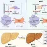 J Hepatol | 安徽医科大学孙倍成研究发现LONP1-DHODH代谢轴或可作为代谢相关脂肪性肝炎肝纤维化治疗新靶点