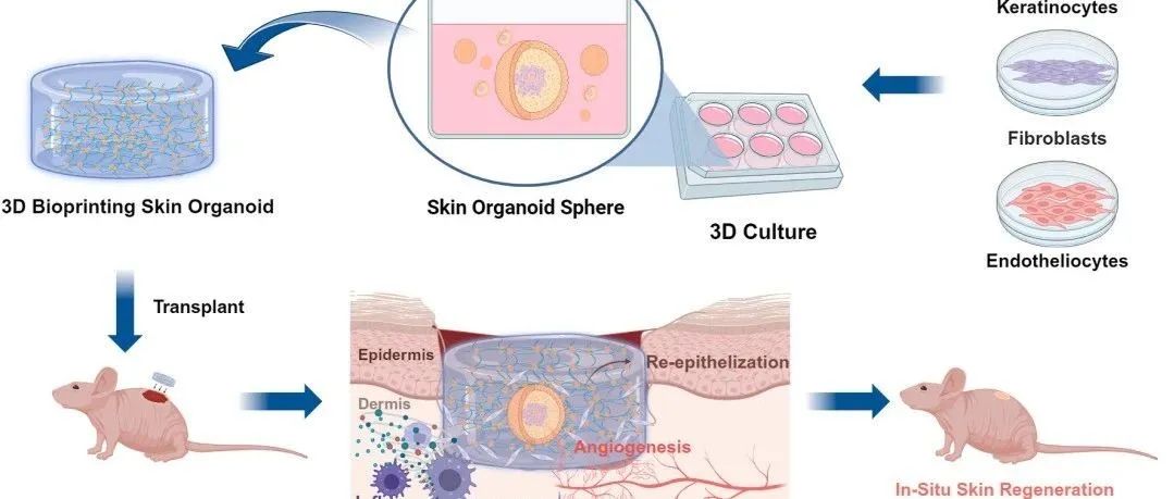 《Bioactive Materials》：如何利用基于GelMA的生物3D打印类器官支架精准修复大面积皮肤缺损？