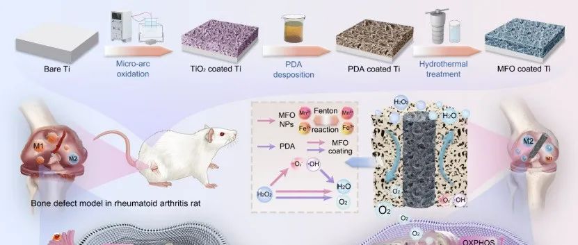 ACS Nano | 纳米酶涂层介导的巨噬细胞线粒体代谢重编程用于类风湿关节炎病例中的免疫调节性骨整合