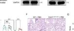 Adv Sci丨同济大学陈昶等团队研究揭示Ly6C+ cDC2s促进急性肺损伤进展和消退的详细机制