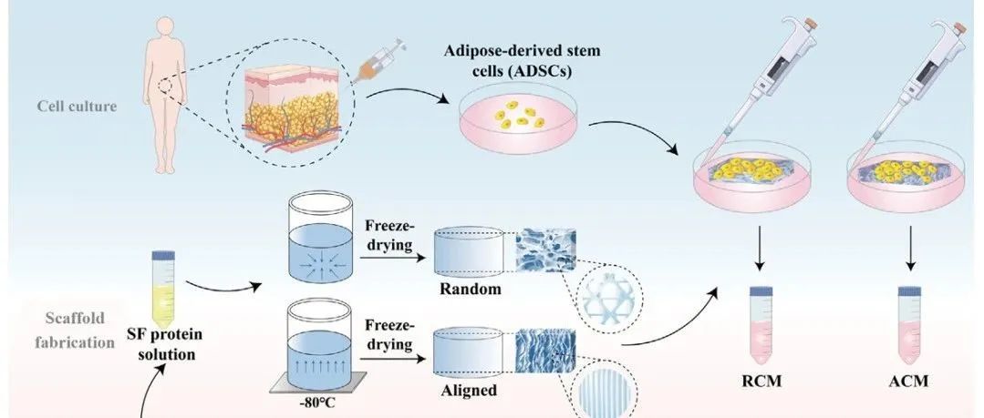 东南大学《Advanced Science》：丝素蛋白支架搭载干细胞重塑肌腱再生