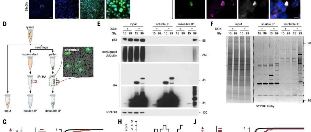 Science | 在GGC重复疾病中聚甘氨酸介导的FAM98B聚集破坏tRNA加工