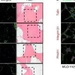 Bone Res丨南方科技大学肖国芝团队发现骨细胞黏连蛋白通过调节小鼠Mef2c驱动的硬化蛋白表达来控制骨量