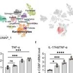 CMI | 北京大学韩文玲等人研究发现CSBF通过双重抑制IL-17A/TNF-α信号通路有效缓解银屑病炎症