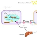 Hepatology | 上海交通大学范广建等团队发现肝纤维化新机制YB-1GLI2通路激活星状细胞