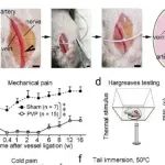 Adv Sci丨南通大学刘兴君等团队研究发现靶向内皮-神经轴及ET-1/ETAR通路或可治疗血管性疼痛