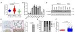 Cell Reports | 天津医科大学姚智/刘冉研究发现C19orf12 在 NSCLC 中高表达并预示预后不良