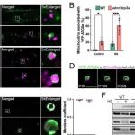 PNAS | 香港中文大学庄小红研究发现植物特有的线粒体裂变机制将线粒体动力学和线粒体自噬体的形成联系起来实现线粒体自噬