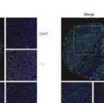 Cell Death Differ | 苏州大学张光波等人研究揭示了TRIM32在NSCLC转移中的作用机制