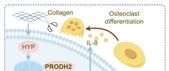 Cancer Res | 中山大学宋立兵等团队研究发现PRODH2–SLC7A11/IL-8轴机制为乳腺癌骨转移提供潜在治疗策略