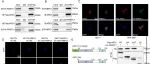 Cancer Res | 武汉大学袁玉峰等团队研究发现乙酰转移酶ARD1诱导谷胱甘肽合成促进肝细胞癌铁凋亡逃逸