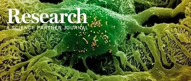 Research | 浙江大学医学院附属儿童医院毛建华/叶青团队揭示足细胞自身抗体致特发性肾病综合征的新机制