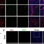 Adv Sci丨西安交通大学张桂莲等团队研究揭示糖代谢调控的MiETosis或成缺血性中风治疗新靶点