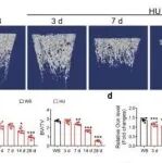 Cell Discover丨上海交通大学张晓玲等团队研究发现靶向 miR-337 可减轻废用性骨质流失