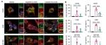 Bone Res丨上海交通大学林盈盈等团队研究发现化疗药物引发的AEP裂解G3BP1可调控骨肉瘤中的应激颗粒/核仁/线粒体