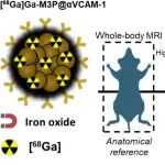 ACS Nano：镓-68标记的聚多巴胺氧化铁颗粒可通过Immuno-PET-MRI监测全身炎症