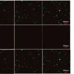 Bioact Mater丨华中科技大学王洪等团队发现纳米MgO负载的热敏HPCH@HA水凝胶通过骨免疫调节加速原位骨修复
