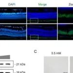 Adv Sci丨南方医科大学安美霞等人研究发现PDZK1-14-3-3ε-mTOR轴调控高糖诱导视网膜色素上皮细胞衰老
