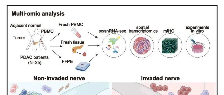 Cancer Cell | 张泽民院士等利用集成的单细胞和空间转录组学揭示了参与胰腺癌神经侵袭的不同细胞亚型