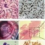 Cell Discovery丨中国科学院魏武等团队研究揭示了非小细胞肺癌脑实质及软脑膜转移的免疫学和病理学特征