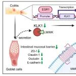 Adv Sci | 南京大学孙洋教授团队揭示结直肠癌新“刹车样分子”-KLK1