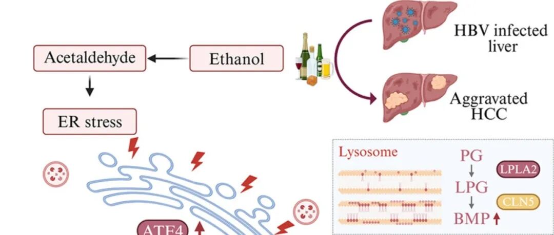 J Hepatol | 中山大学吴斌研究揭示了酒精介导的代谢重编程在HBV-HCC中的促瘤作用