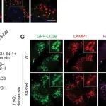 Autophagy丨浙江大学刘伟研究揭示了 ATG16L1 去乙酰化在驱动 LC3 相关微自噬中发挥关键作用，以维持溶酶体稳态