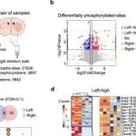 Cell Res丨浙江大学许执恒等人揭示哺乳动物大脑侧化分子机制，并关联自闭症发展与治疗策略
