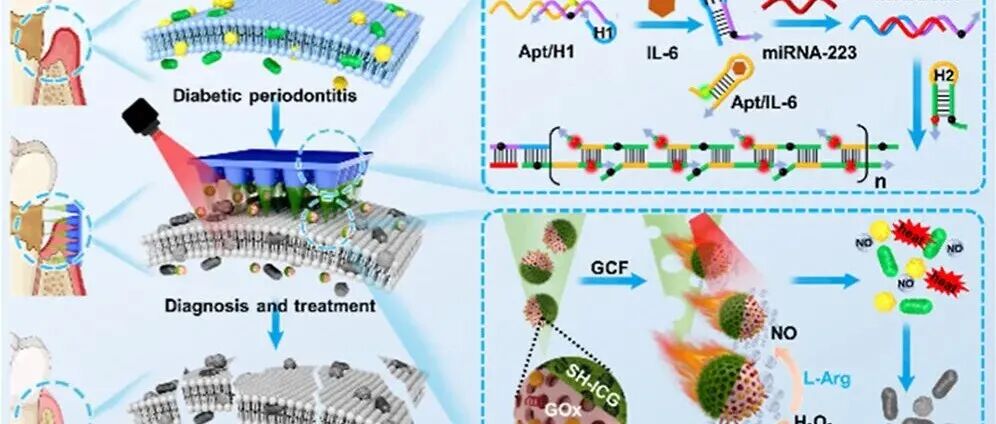 AC.通过生物标志物响应探针和光热NO纳米电机进行糖尿病牙周炎原位诊断和生物膜靶向治疗的双功能微针