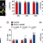 Adv Sci丨浙江大学徐银川等人研究表明肝脏AGT是HFpEF发病机制的致病因素