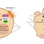 Cancer Res | 查岱龍研究发现MYADM是潜在的抗转移治疗靶点，为临床干预提供了新方向