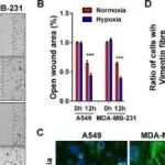 Adv Sci丨浙江大学王娴等人研究发现波形蛋白R64 aDMA为转移调控因子，抑制PRMT1或成抗转移新策略