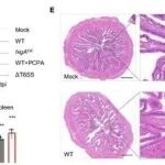 Cell Reports | 华东理工大学邵帅/王启要研究发现细菌抗毒素HigA以T6SS依赖的方式破坏宿主肠道血清素稳态