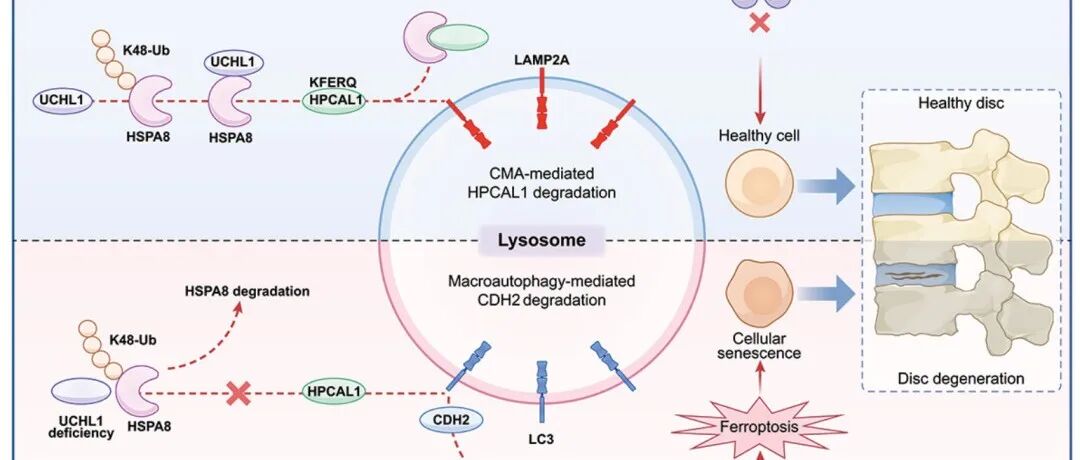 Autophagy | 温州医科大学王向阳/王成贵团队揭示UCHL1通过激活CMA拮抗铁死亡延缓髓核细胞衰老和椎间盘退变的新机制