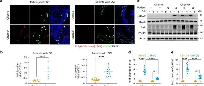 NCB丨四川大学曹中炜等人研究发现MLKL PARylation是肿瘤血管ECs坏死性凋亡的重要步骤