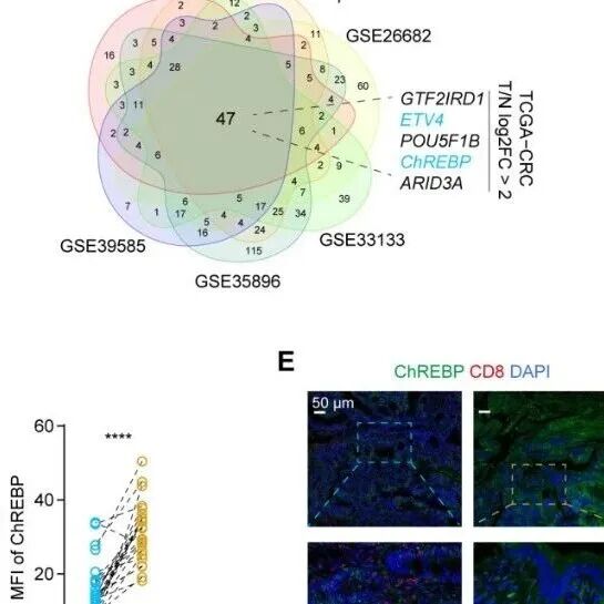 Cancer Research | 武汉大学张金方等团队研究发现ChREBP促进免疫逃逸