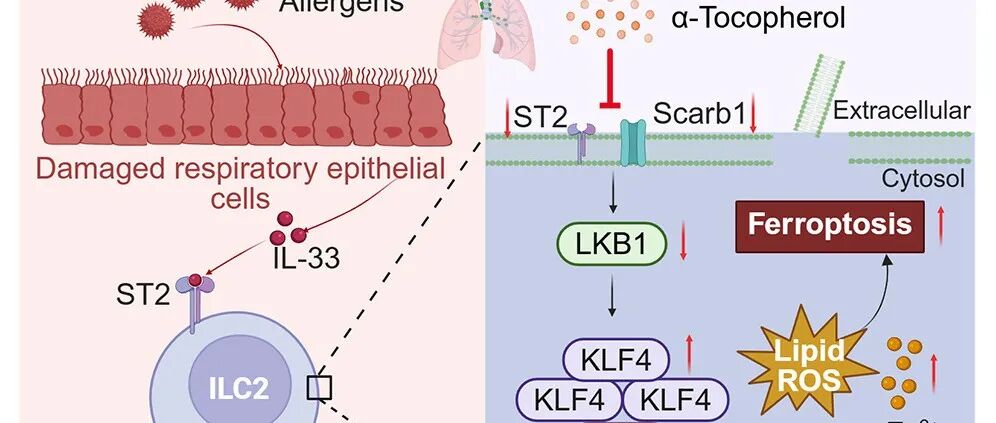 Molecular Therapy | 南方医何玉梅团队揭示饮食免疫的新机制：α-Toc可改善过敏气道炎症