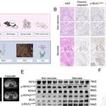 Cancer Res | 福建省医院陈实等团队研究发现TRAF3IP2-AS1缺失诱导坏死性凋亡促进胰腺癌肝转移