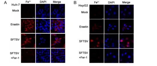 Autophagy | 南京医科大学朱进/吴稚伟揭示SFTSV通过m6A修饰ATG5触发肝铁蛋白自噬依赖性铁死亡