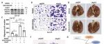 Cell Death Differ | 四川大学李成华等团队研究揭示PRMT5通过抑制转录因子ΔNp63α在TSCC中的致癌作用