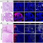 Cancer Res | 空军医科大学秦卫军团队合作揭示LHX2重组代谢和表观遗传景观驱动前列腺癌肿瘤进展